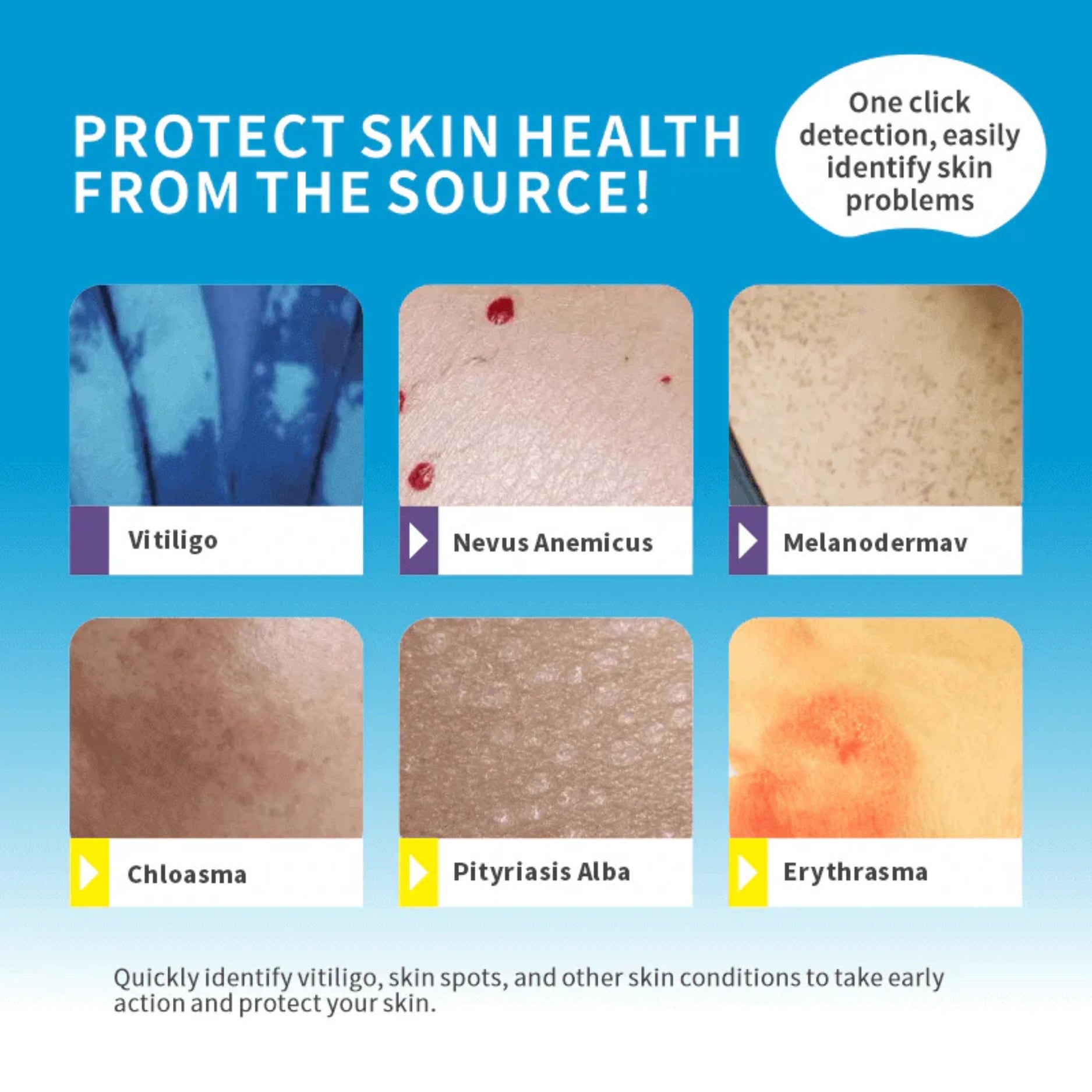 LAMPARA DE WOOD LUZ NEGRA UV INALAMBRICA BATERIA RECARGABLE