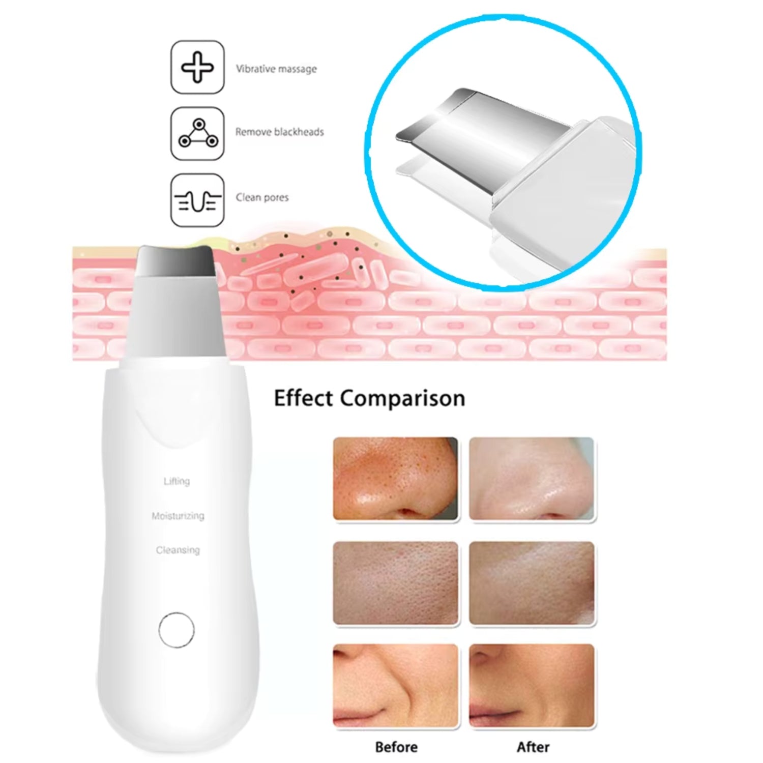 SKIN SCRUBBER INALAMBRICO ULTRASONICO LIMPIEZA FACIALCUIDADO DE LA PIEL#